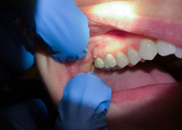 Best Mobile Emergency Dentist in De Motte, IN