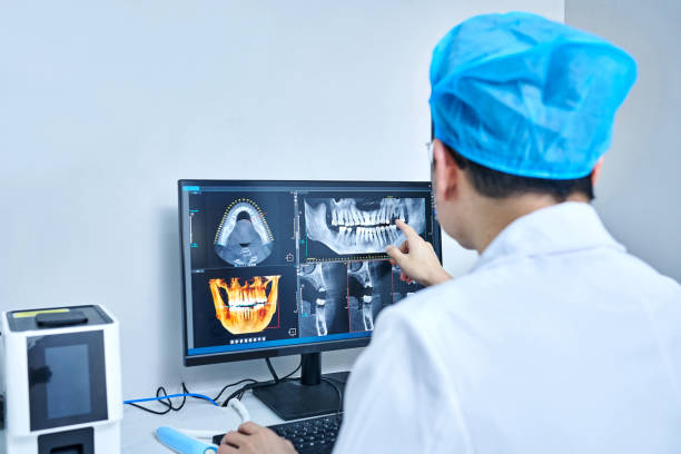 Best Emergency Root Canal Treatment in De Motte, IN